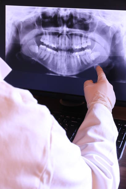 Best Emergency Tooth Extraction in Clarkesville, GA