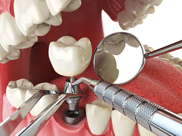 Best Emergency Dental Care for Trauma or Injury in Clarkesville, GA
